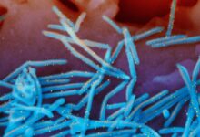 Photo of RSV is still spreading, prompting states to extend the immunization period